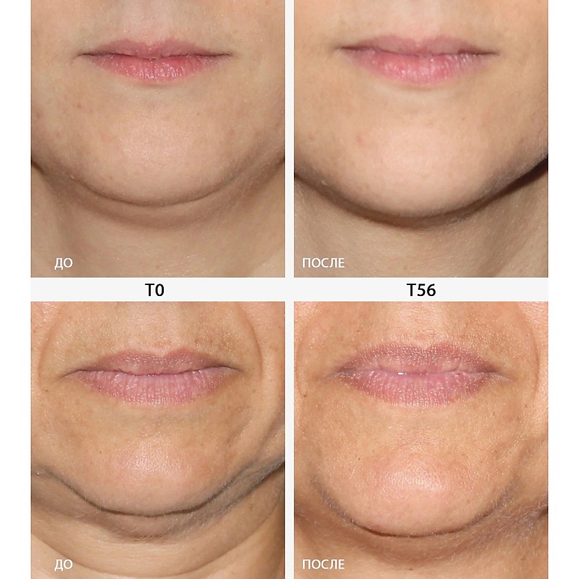 EISENBERG Сыворотка, корректирующая овал лица, Serum Affinant Visage – фото 2