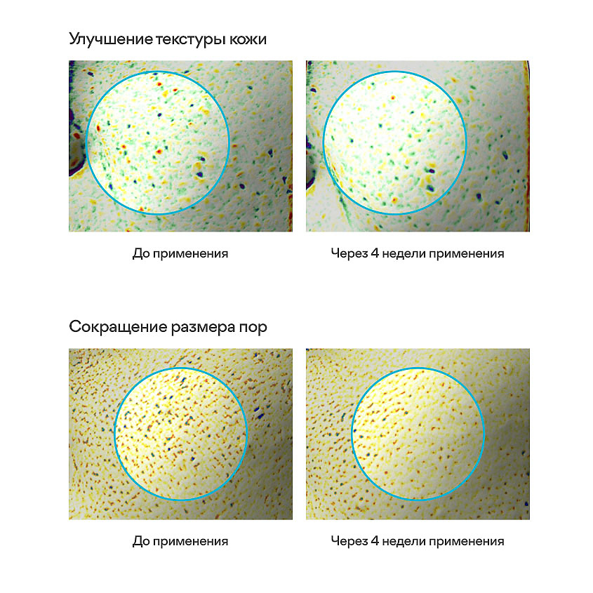 INNISFREE Корректирующий крем с ретинолом и центеллой азиатской для ухода за кожей, склонной к акне Retinol Cica – фото 6