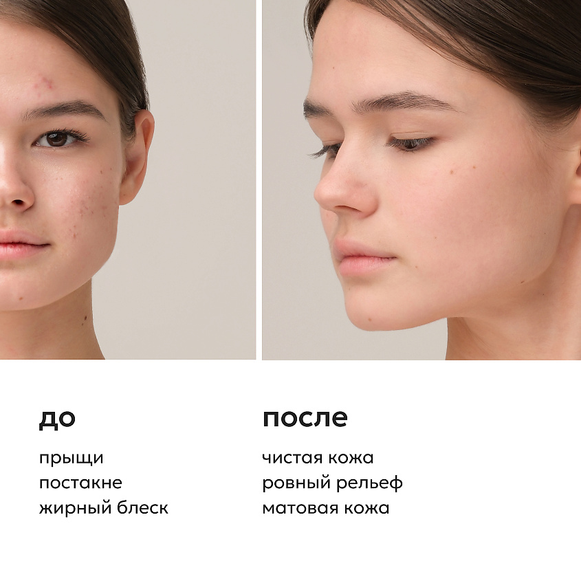 LIKATO Крем-флюид для лица с ретинолом акне-контроль Retinol And Vitamin E Face Cream – фото 4