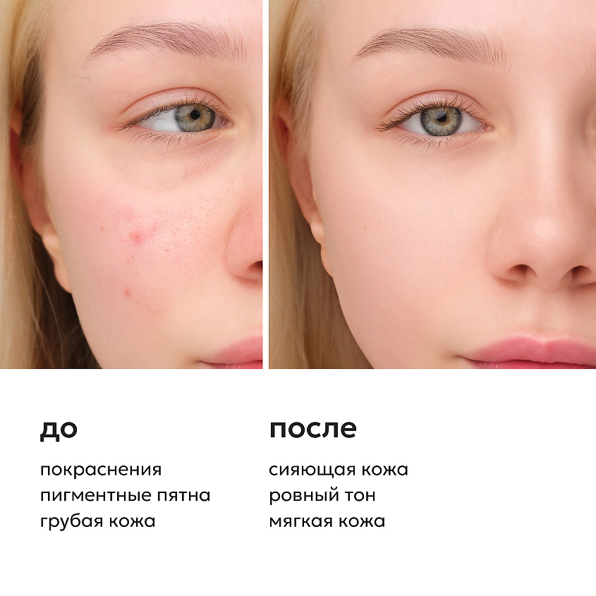 LIKATO Пилинг-пэды для совершенной кожи с AHА-кислотами и витамином С Vitamin C Peeling Pad – фото 4